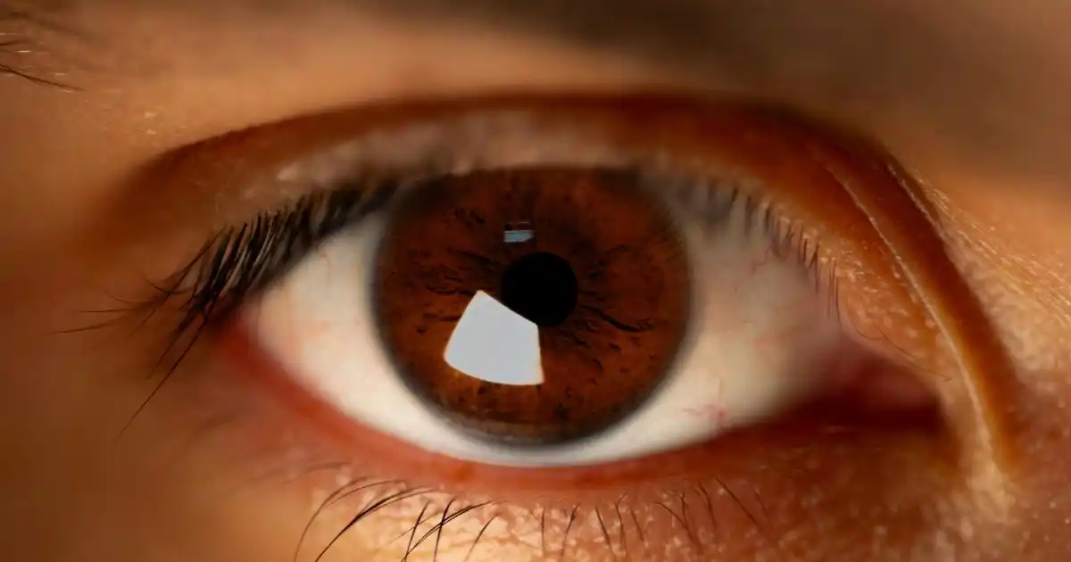 Implant Oculaire : Types, Prix et Remboursement 2026