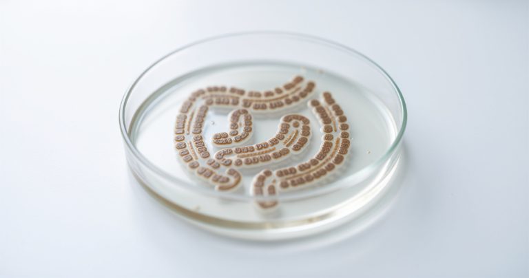 Cancer colorectal : première cause de mortalité avant 50 ans