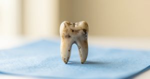 Restes humains en labo : l'éthique face aux analyses destructrices